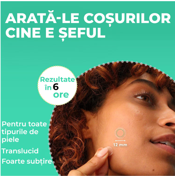 Plasturi anti acnee  Regal Bliss ®