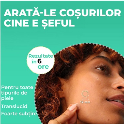 Plasturi anti acnee  Regal Bliss ®