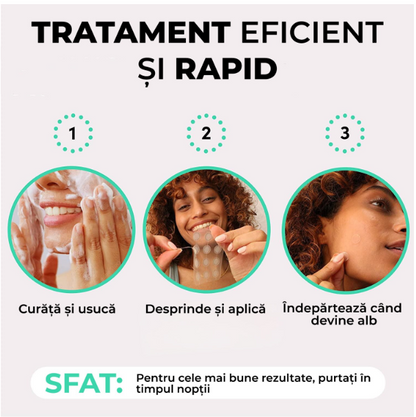 Plasturi anti acnee  Regal Bliss ®