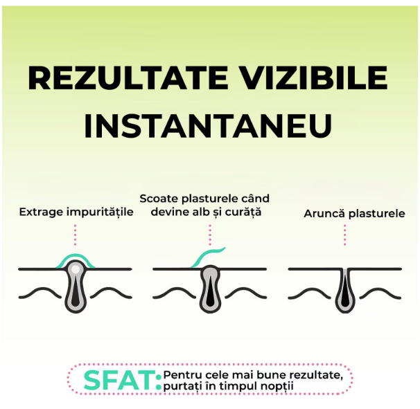 Plasturi anti acnee  Regal Bliss ®