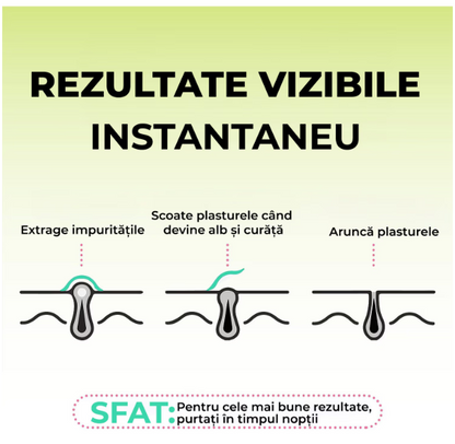 Plasturi anti acnee  Regal Bliss ®